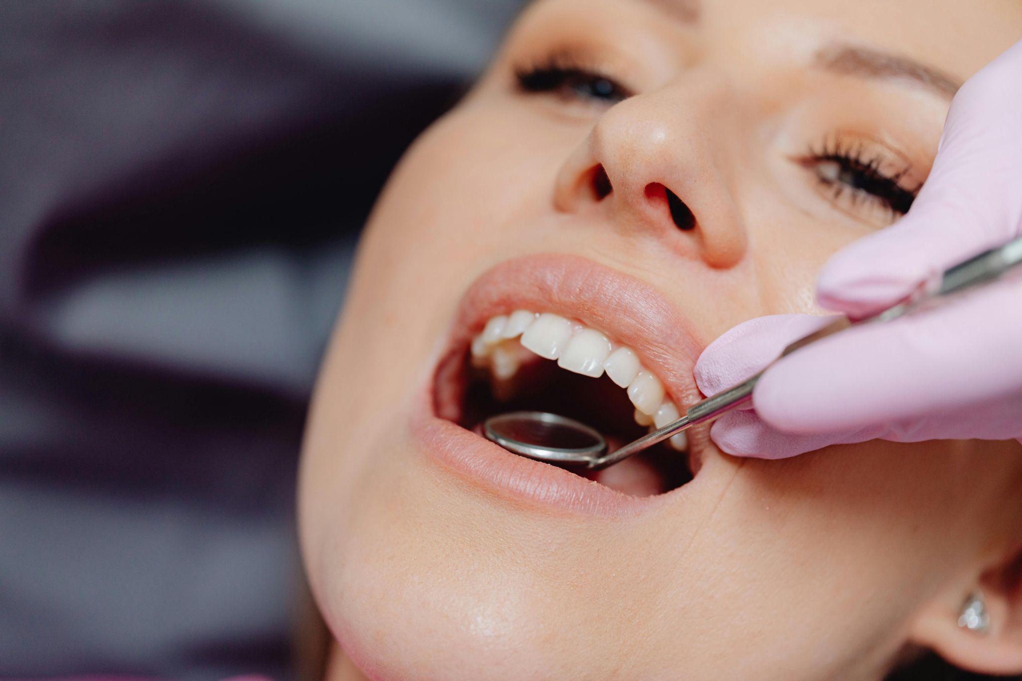 Why Regular Dental Checkups Matter More Than You Think